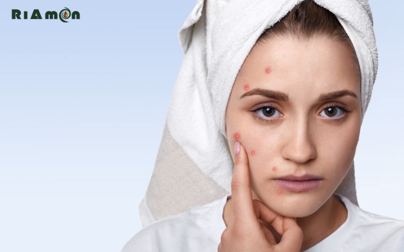 Tổng hợp 5 công dụng của tinh dầu mù u mà bạn nên biết! Tổng hợp 5 công dụng của tinh dầu mù u mà bạn nên biết!